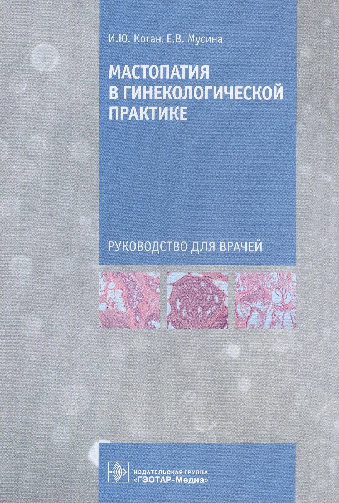 Мастопатия в гинекологической практике: руководство для врачей