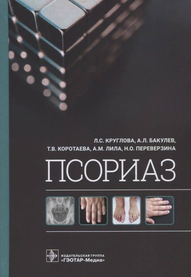 Псориаз