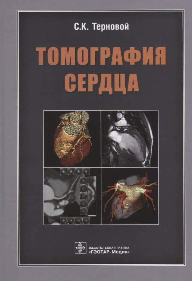 Томография сердца — Татьяна Николаевна Веселова