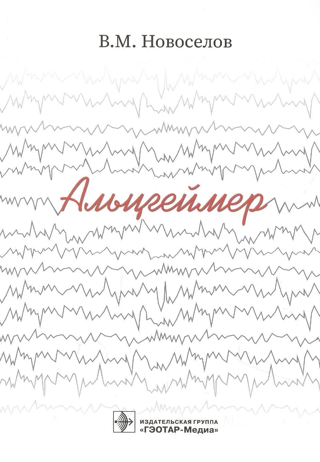 Альцгеймер