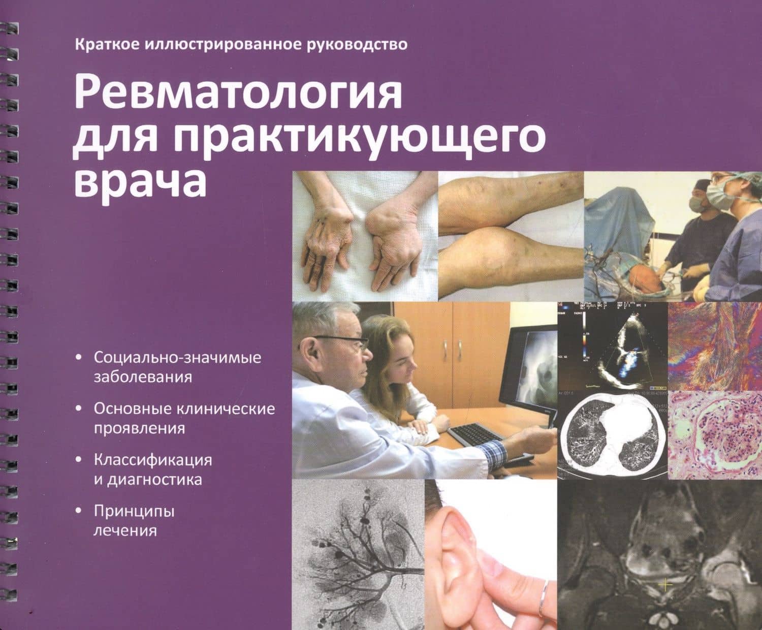 Краткое иллюстрированное руководство "Ревматология для практикующего врача" — Л. П. Ананьева