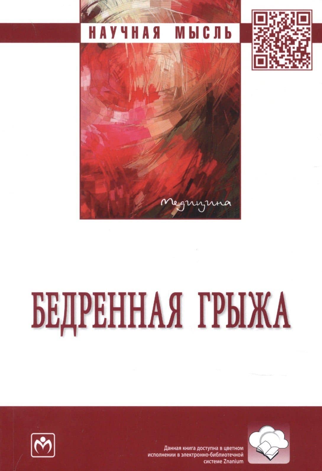 Бедренная грыжа. Монография