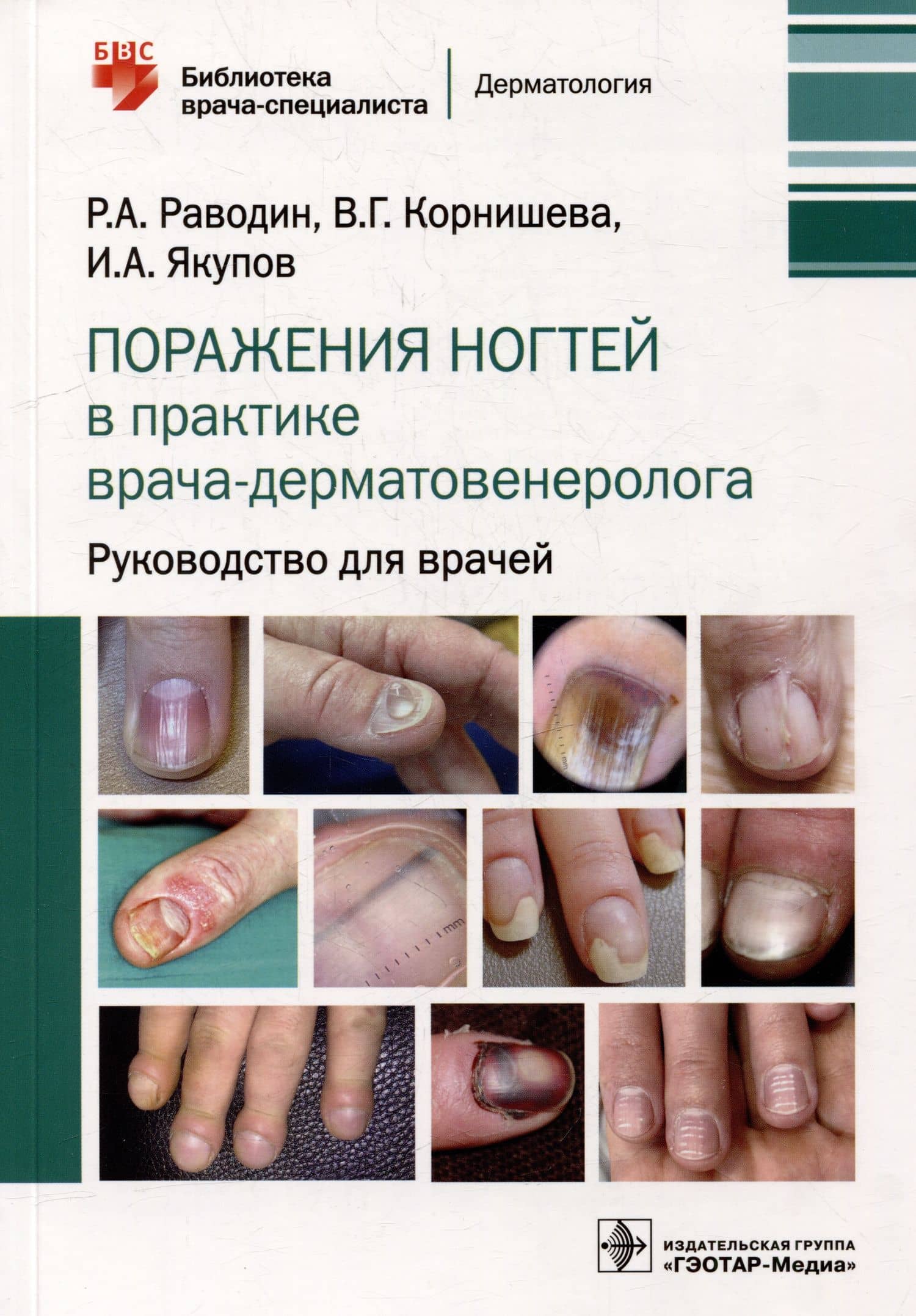 Поражения ногтей в практике врача-дерматовенеролога: руководство для врачей