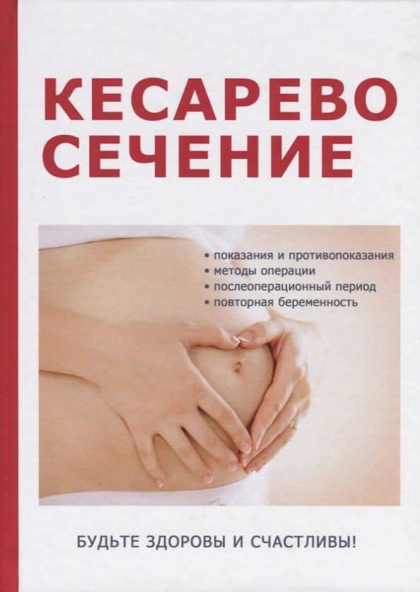 Кесарево сечение — Марина Геннадиевна Дрангой