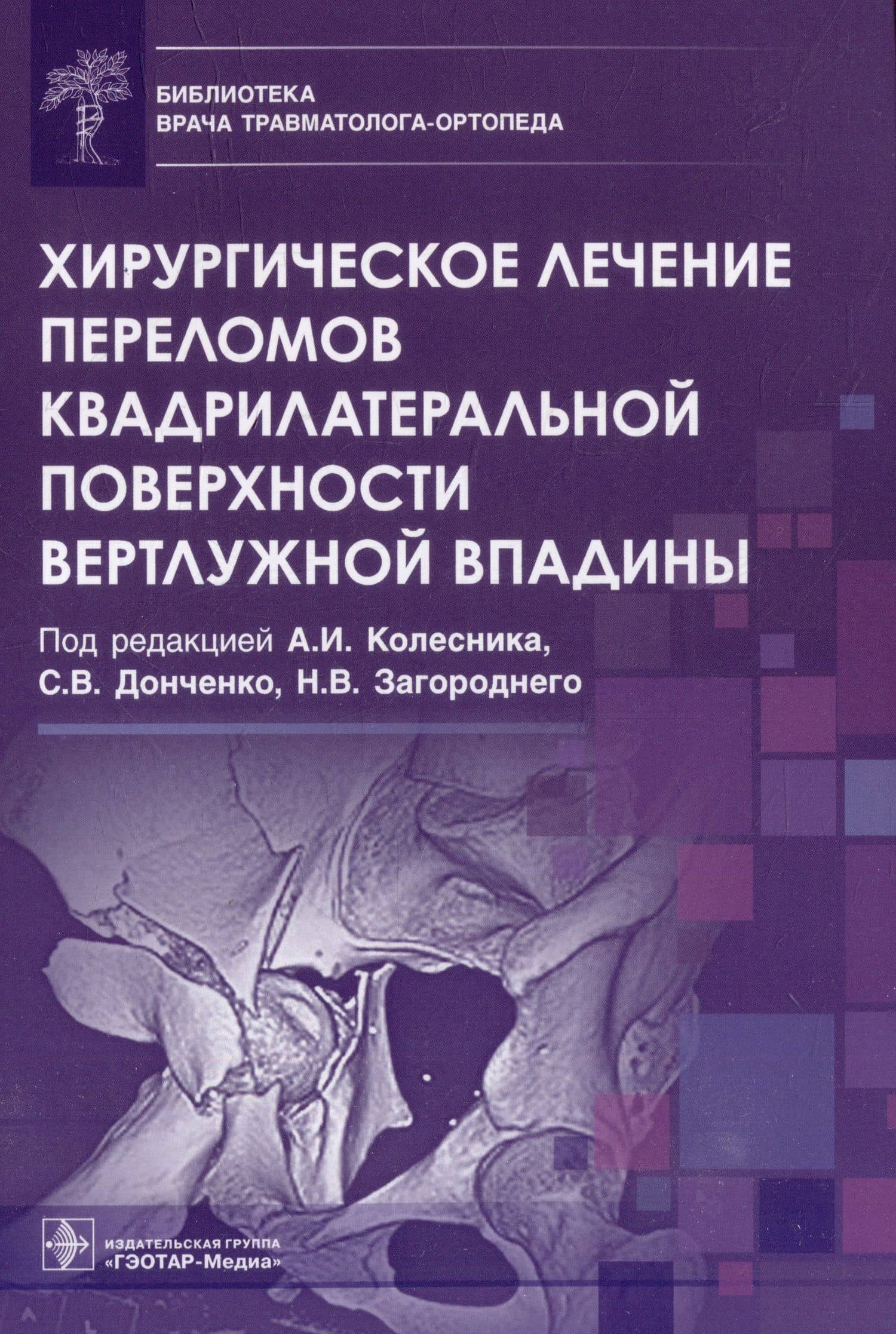 Хирургическое лечение переломов квадрилатеральной поверхности вертлужной впадины — Сергей Викторович Донченко