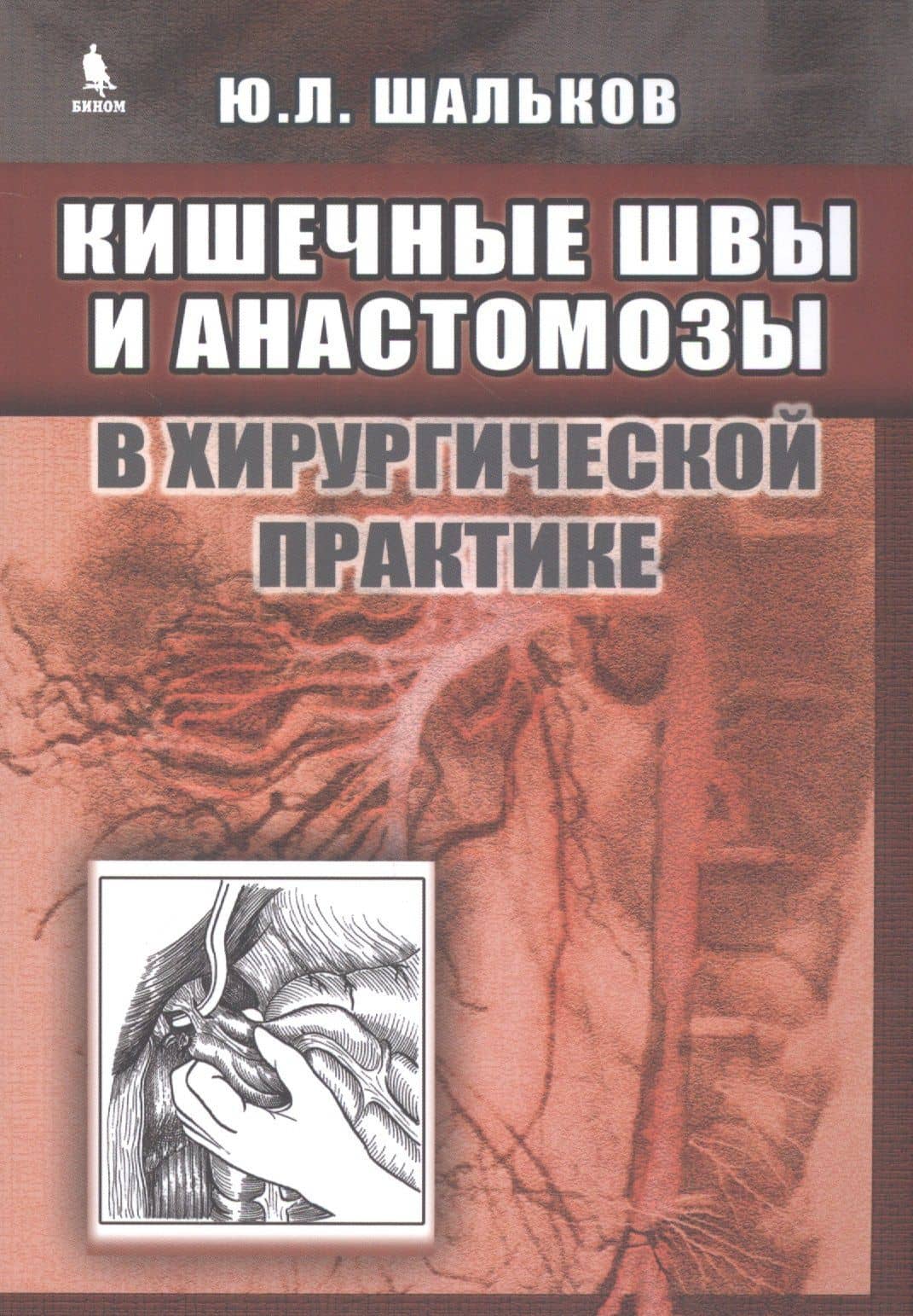 Кишечные швы и анастомозы в хирургической практике