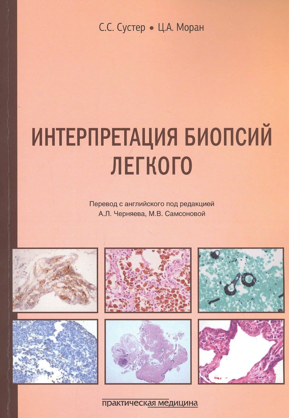 Интерпретация биопсий легкого — С. С. Сустер