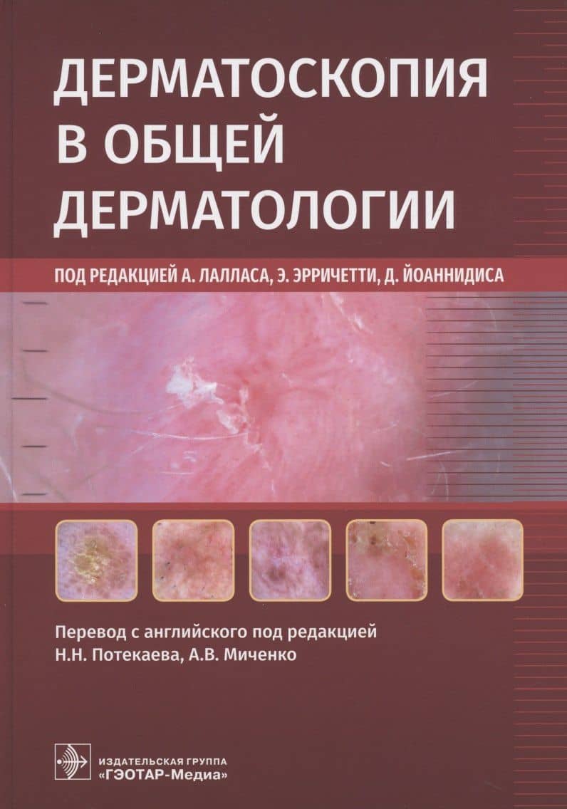 Дерматоскопия в общей дерматологии