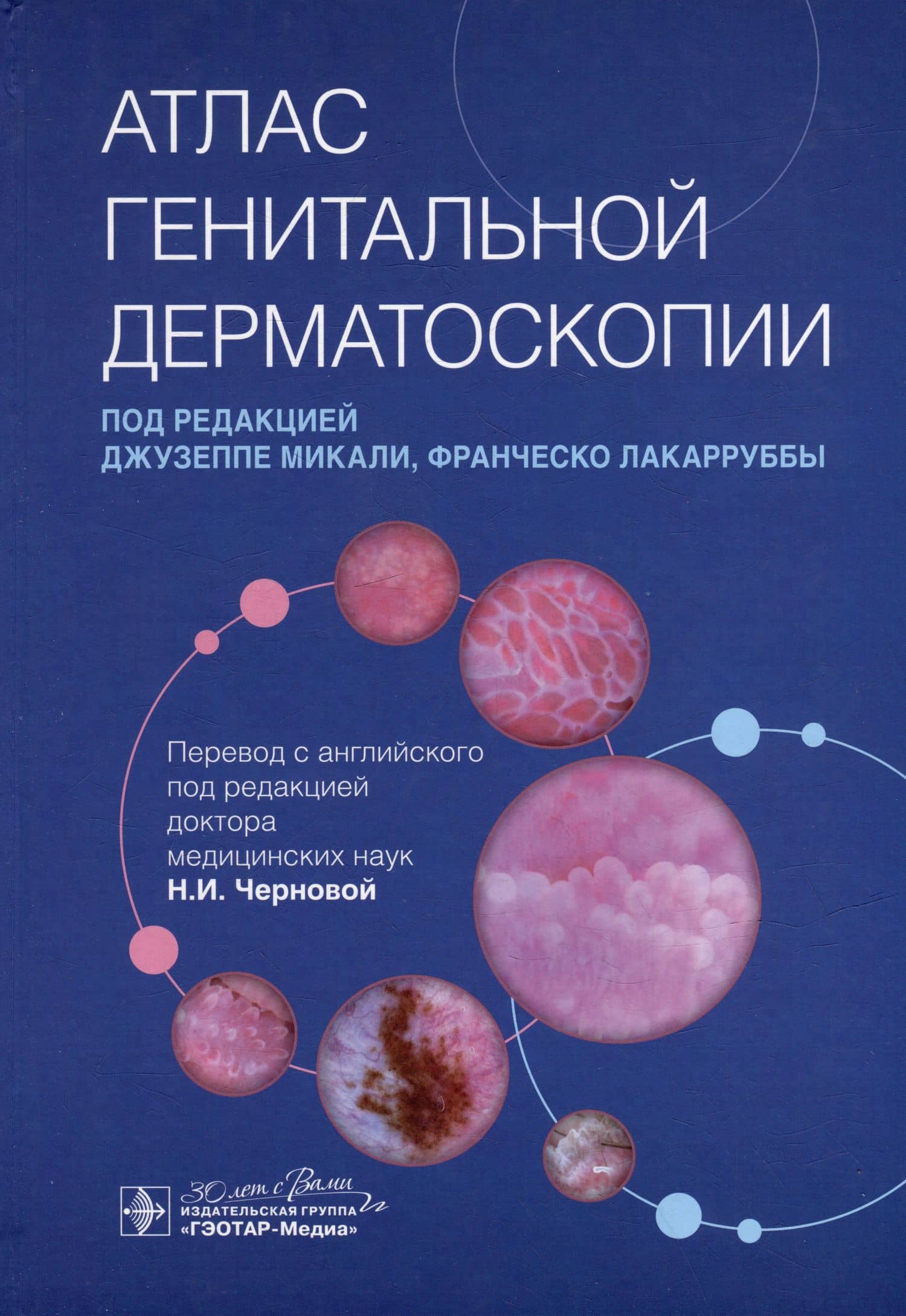Атлас генитальной дерматоскопии