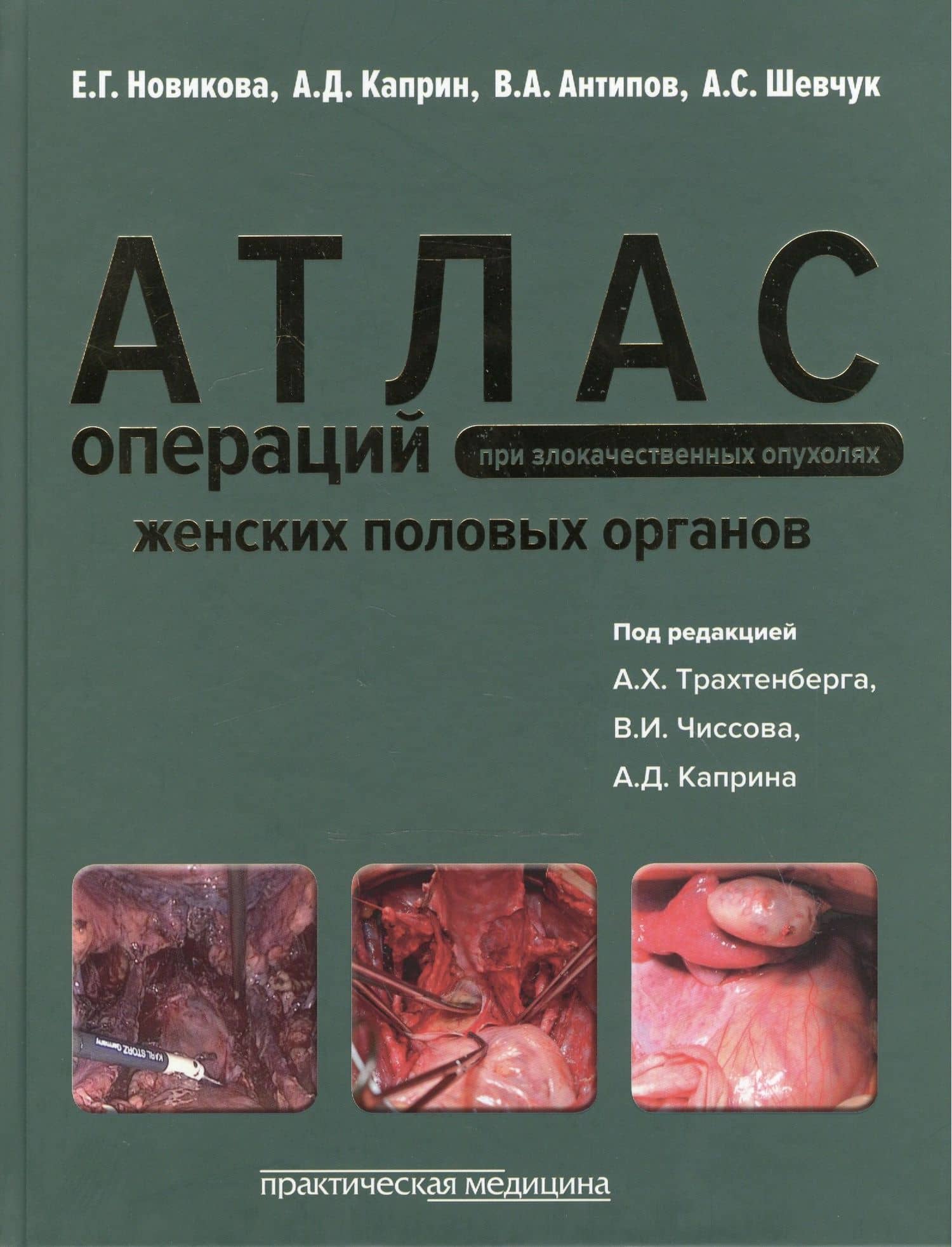 Атлас операций при злокачественных опухолях женских половых органов (Новикова)
