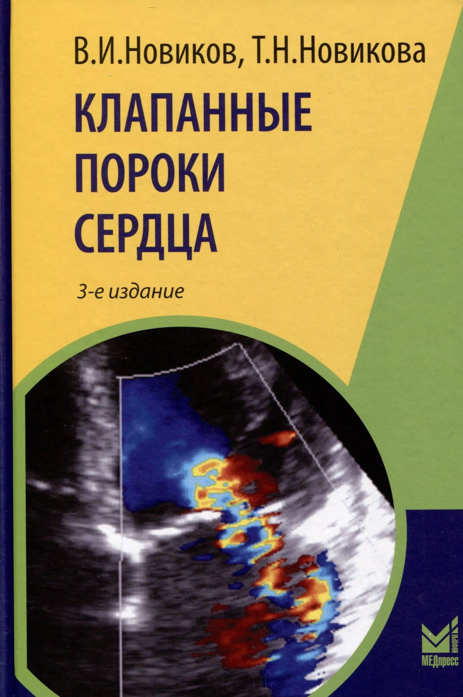 Клапанные пороки сердца