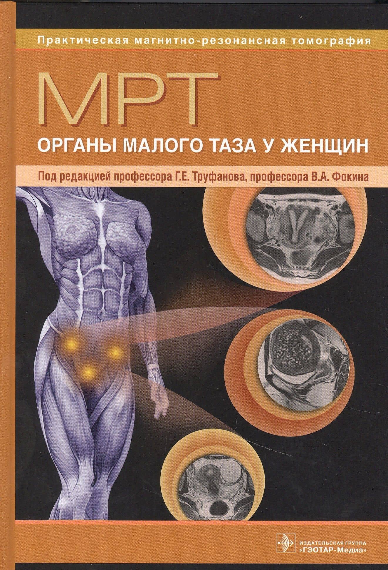 МРТ. Органы малого таза у женщин: руководство для врачей