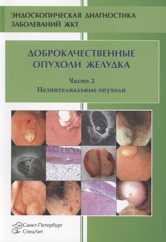 Доброкачественные опухоли желудка. Часть 2 Неэпителиальные опухоли — Михаил Николаевич Кузин