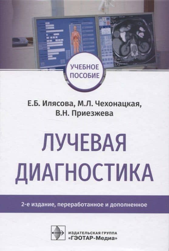 Лучевая диагностика
