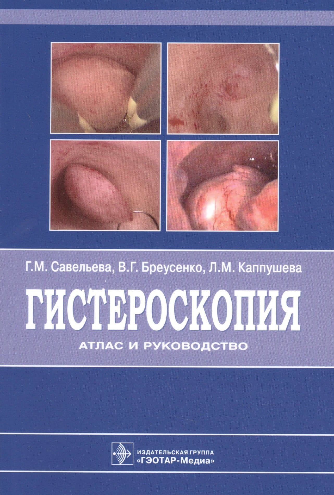 Гистероскопия : атлас и руководство. 2-е издание, дополненное и переработанное