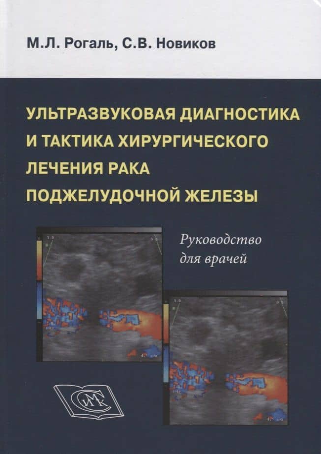 Ультрозвуковая диагностика и тактика хирургического лечения рака поджелудочной железы. Руководство для врачей