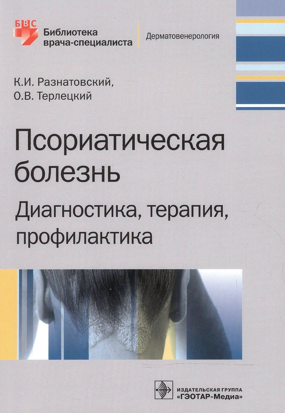 Псориатическая болезнь. Диагностика, терапия, профилактика