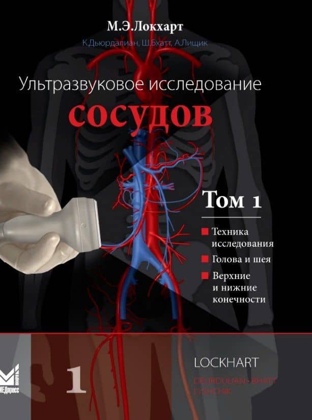 Ультразвуковое исследование сосудов. Том 1 — Марк Э. Локхарт