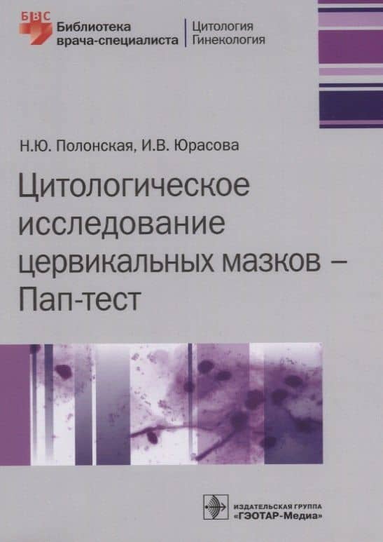 Цитологическое исследование цервикальных мазков Пап-тест (мБиблВрСпец) Полонская