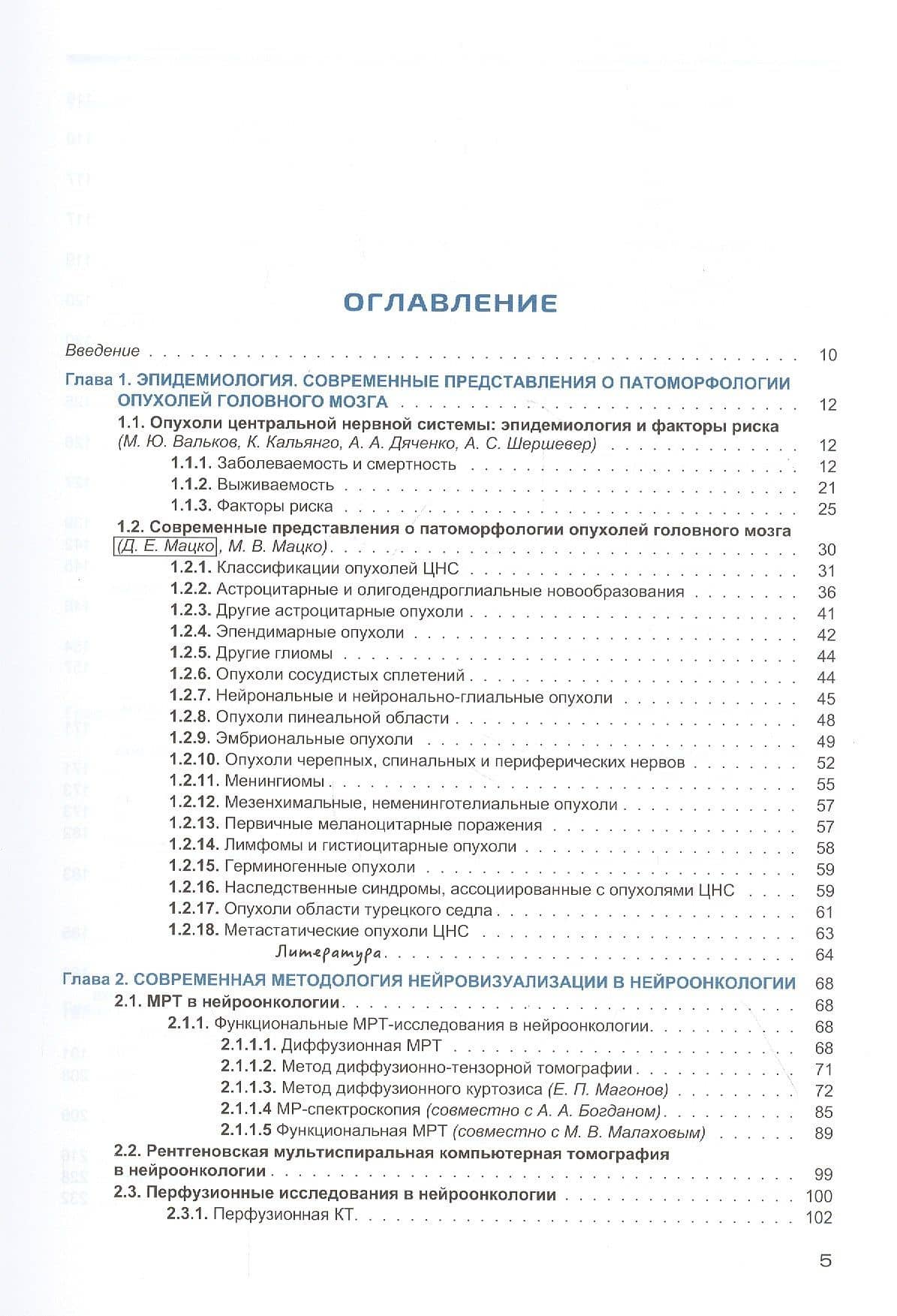 Радиология церебральных глиом диагностика и мониторинг — Жанна Игоревна Савинцева (2)