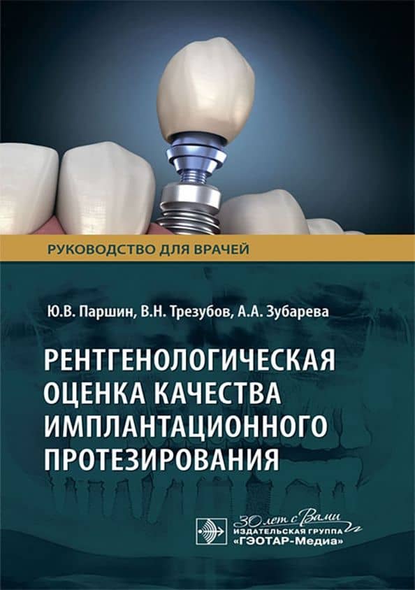 Рентгенологическая оценка качества имплантационного протезирования. Руководство