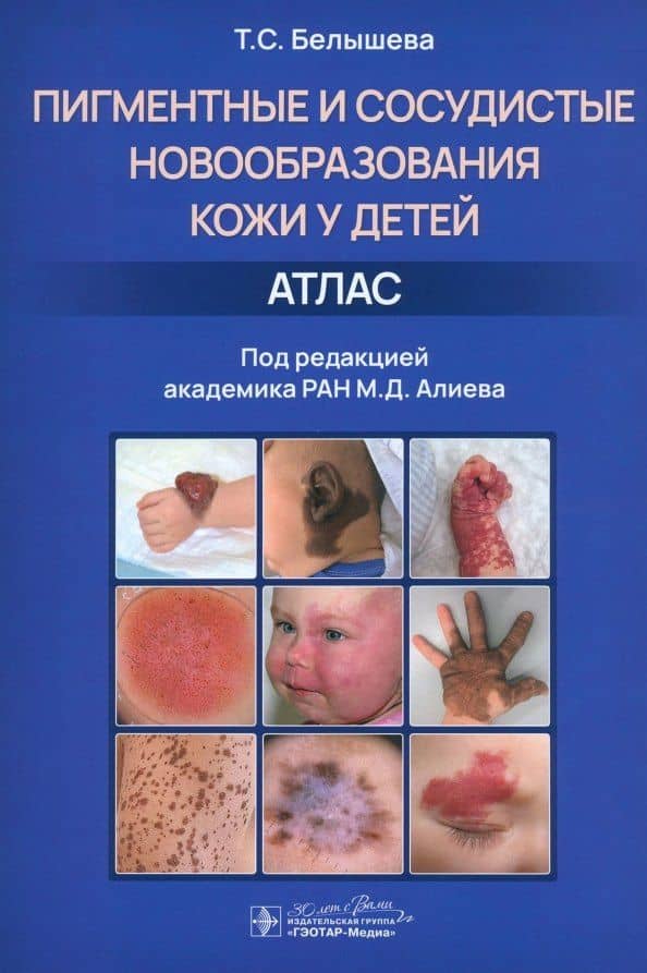 Пигментные и сосудистые новообразования кожи у детей. Атлас — Белышева Татьяна Сергеевна