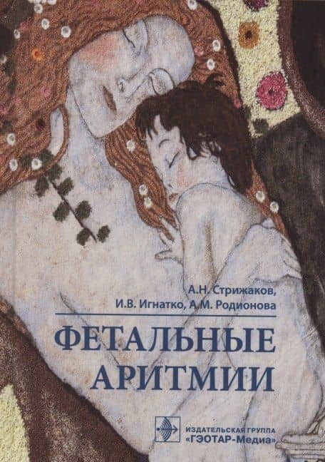 Фетальные аритмии — Александр Николаевич Стрижаков