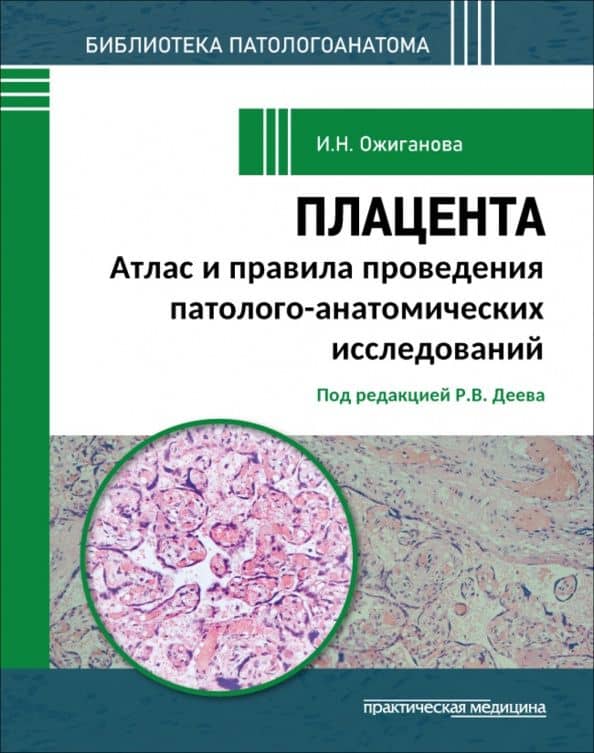 Плацента. Атлас и правила проведения патолого-анатомических исследований — Ирина Николаевна Ожиганова