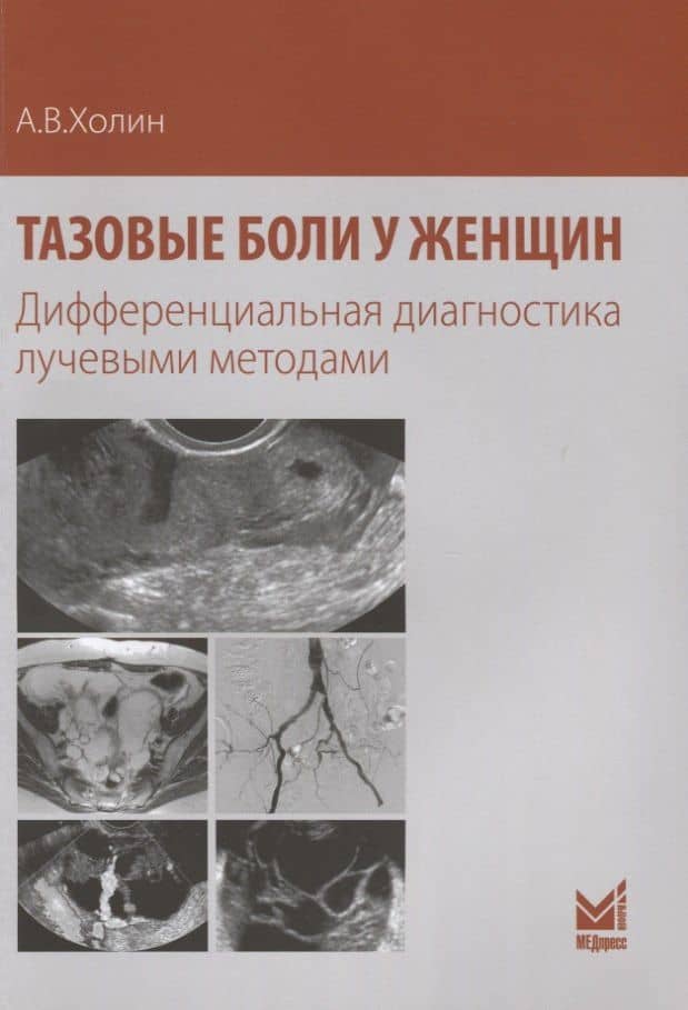 Тазовые боли у женщин Дифференциальная диагностика лучевыми методами (м) Холин — Александр Васильевич Холин