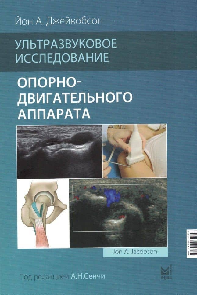 Ультразвуковое исследование опорно-двигательного аппарата — Йон А. Джейкобсон