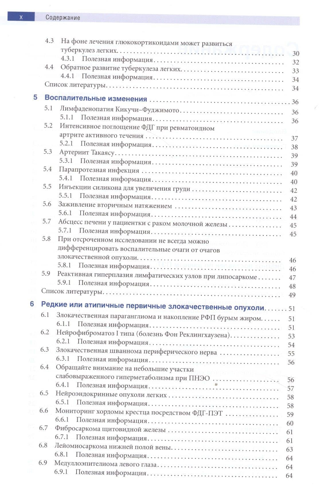 Позитронно-эмиссионная томография с компьютерной томографией (ПЭТ/КТ) — Джонас Франсиско И. Сантьяго (3)