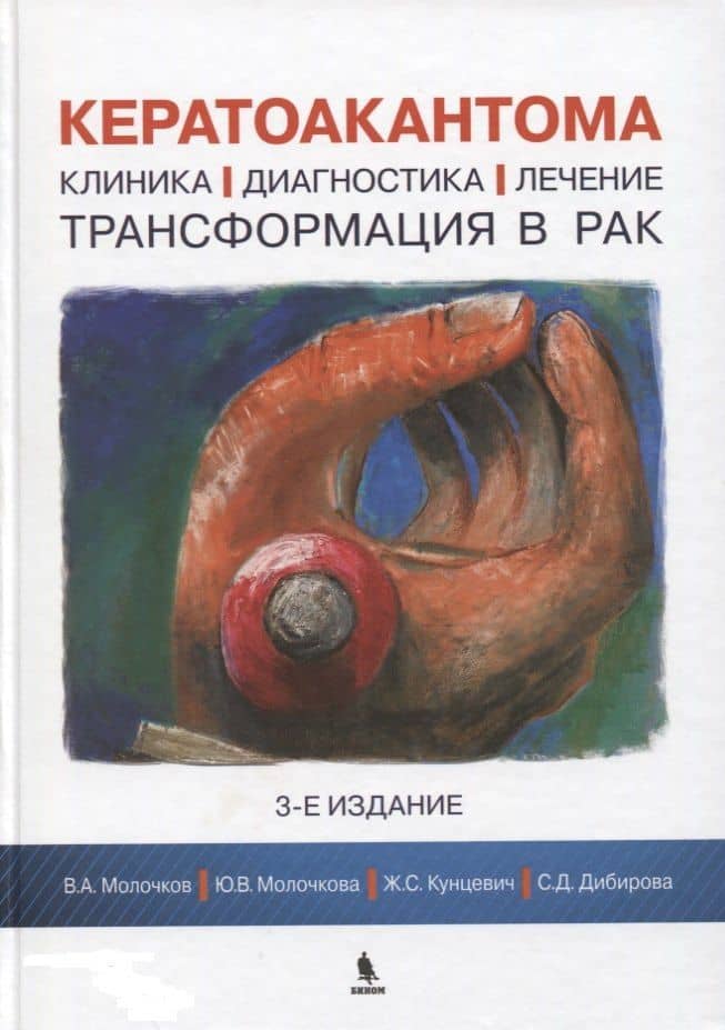 Кератоакантома. Клиника, диагностика, лечение, трансформация в рак. 3-е издание — Владимир Алексеевич Молочков