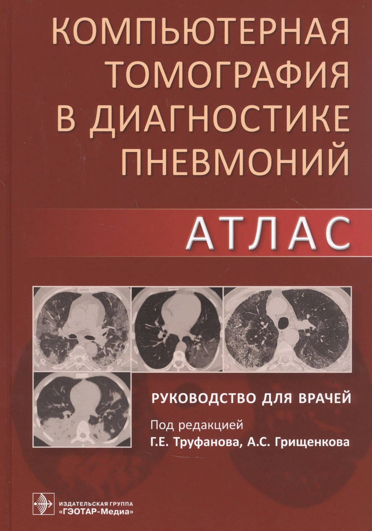 Компьютерная томография в диагностике пневмоний. Атлас. Руководство для врачей — Геннадий Евгеньевич Труфанов
