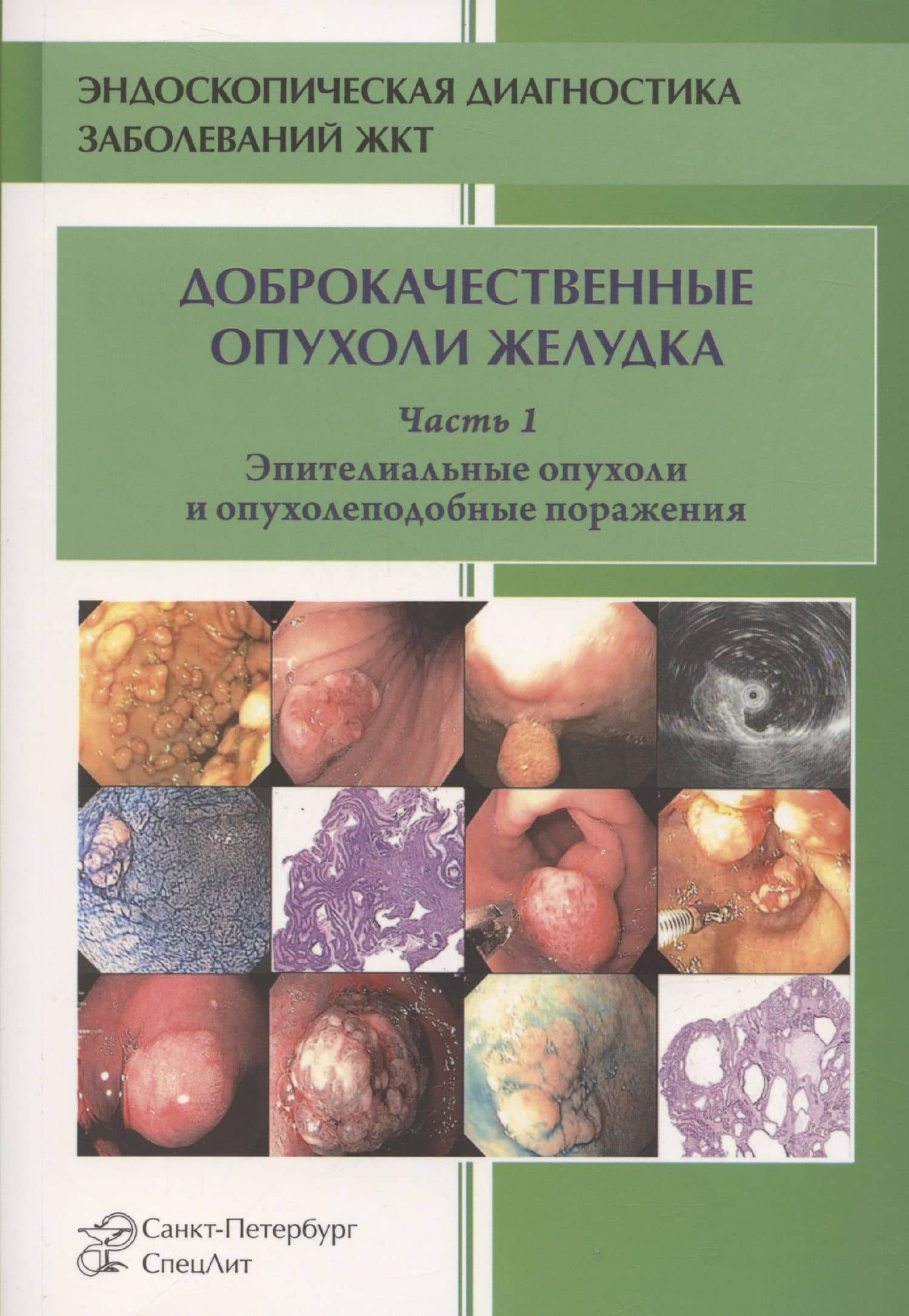 Доброкачественные опухоли желудка. Часть 1. Эпителиальные опухоли и опухолеподобные поражения. Учебно-методическое пособие
