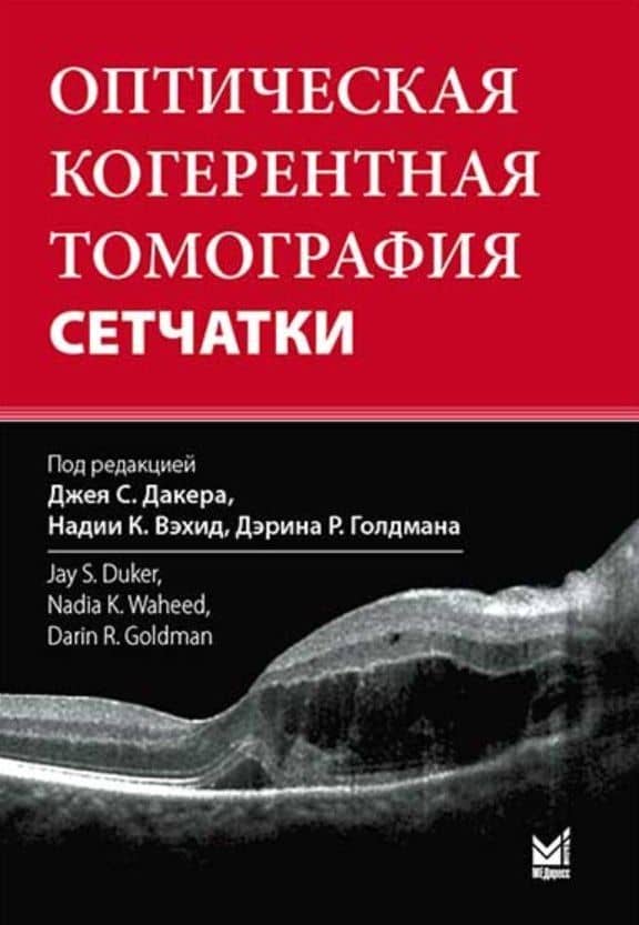 Оптическая когерентная томография сетчатки (2)