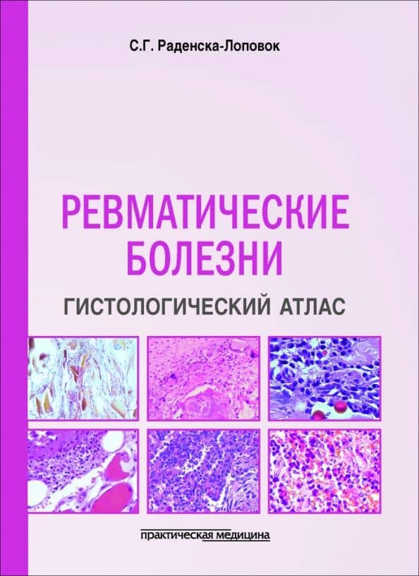 Ревматические болезни. Гистологический атлас — Стефка Господиновна Раденска-Лоповок