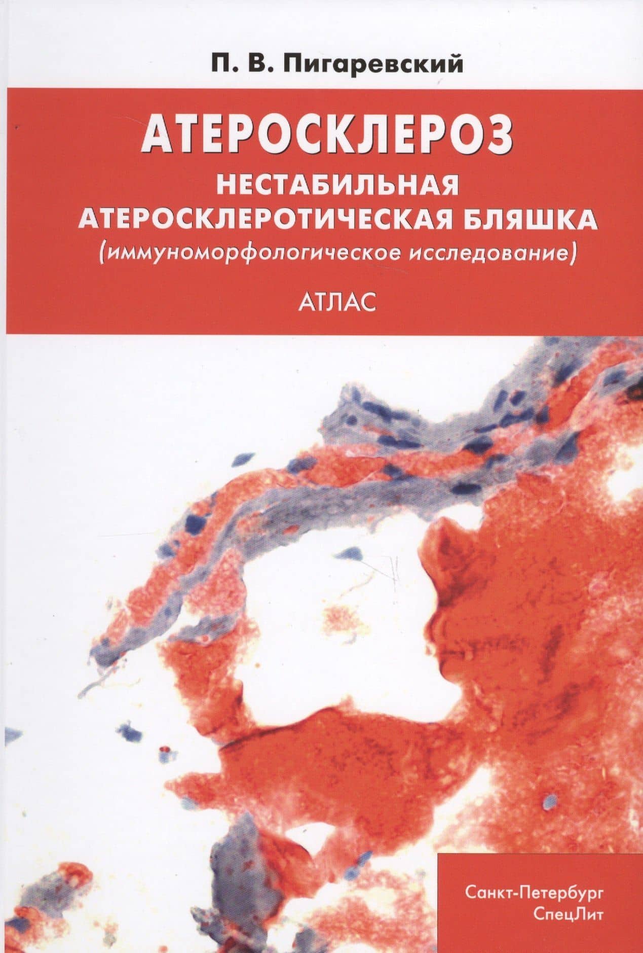 Атеросклероз. Нестабильная атеросклеротическая бляшка (иммуноморфологическое исследование). Атлас — Петр Валерьевич Пигаревский