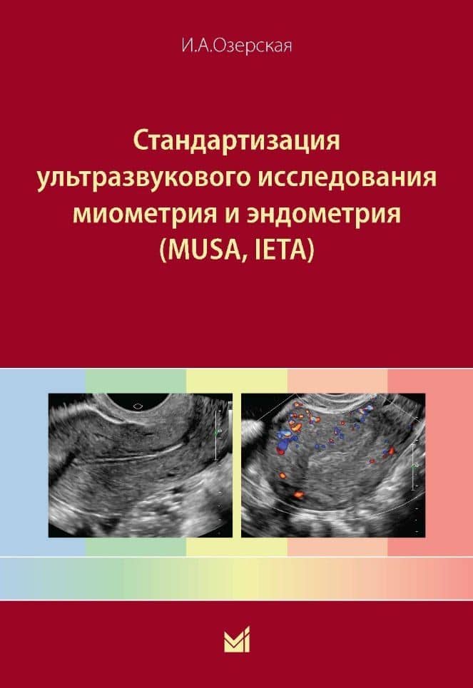 Стандартизация ультразвукового исследования миометрия и эндометрия (MUSA, IETA) — Ирина Аркадьевна Озерская