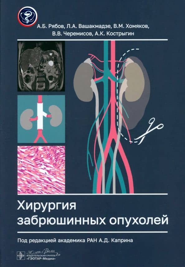 Хирургия забрюшинных опухолей