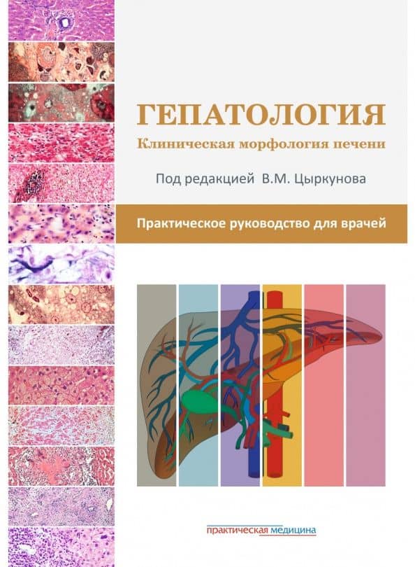 Гепатология. Клиническая морфология печени. Практическое руководство для врачей — Виктор Павлович Андреев