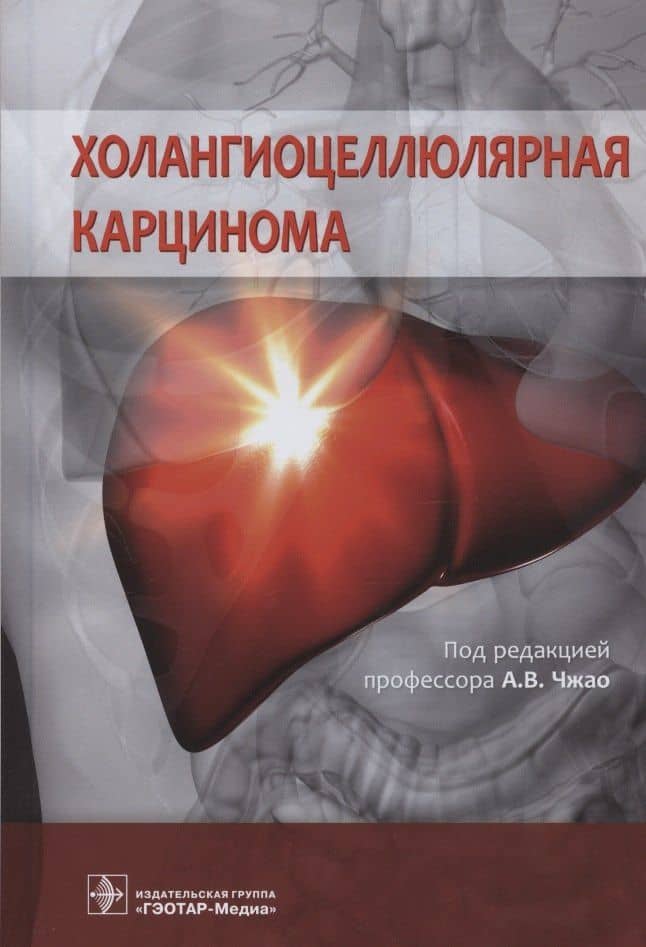 Холангиоцеллюлярная карцинома — С. А. Бугаев