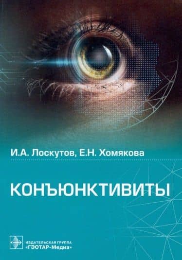 Конъюнктивиты