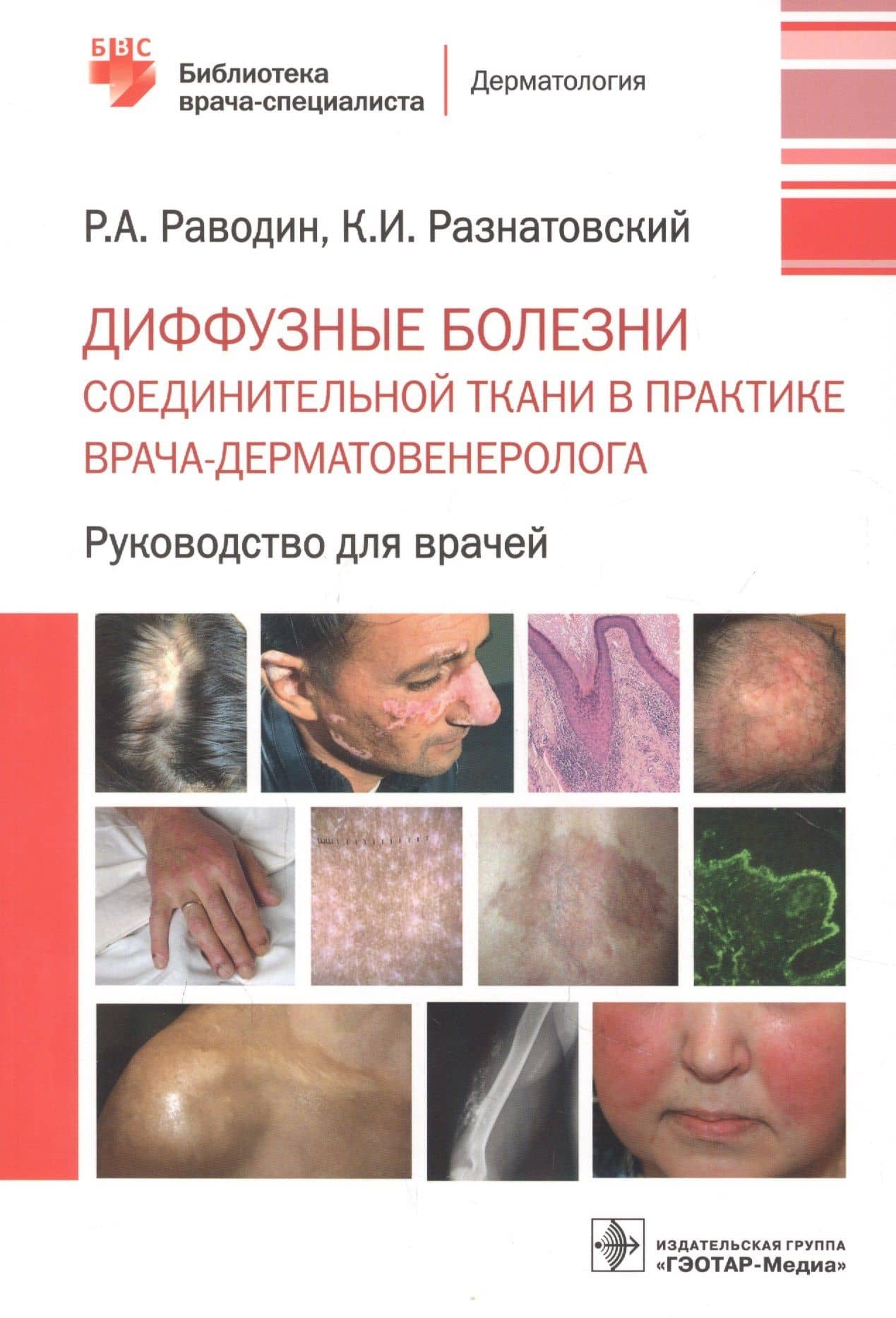 Диффузные болезни соединительной ткани в практике врача-дерматовенеролога. Руководство для врачей