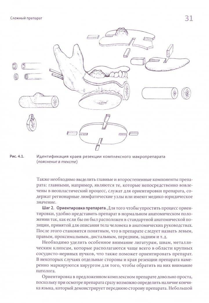 Макроскопическое исследование биопсийного и операционного материала. Руководство для врачей — В. А. Хоржевский (3)