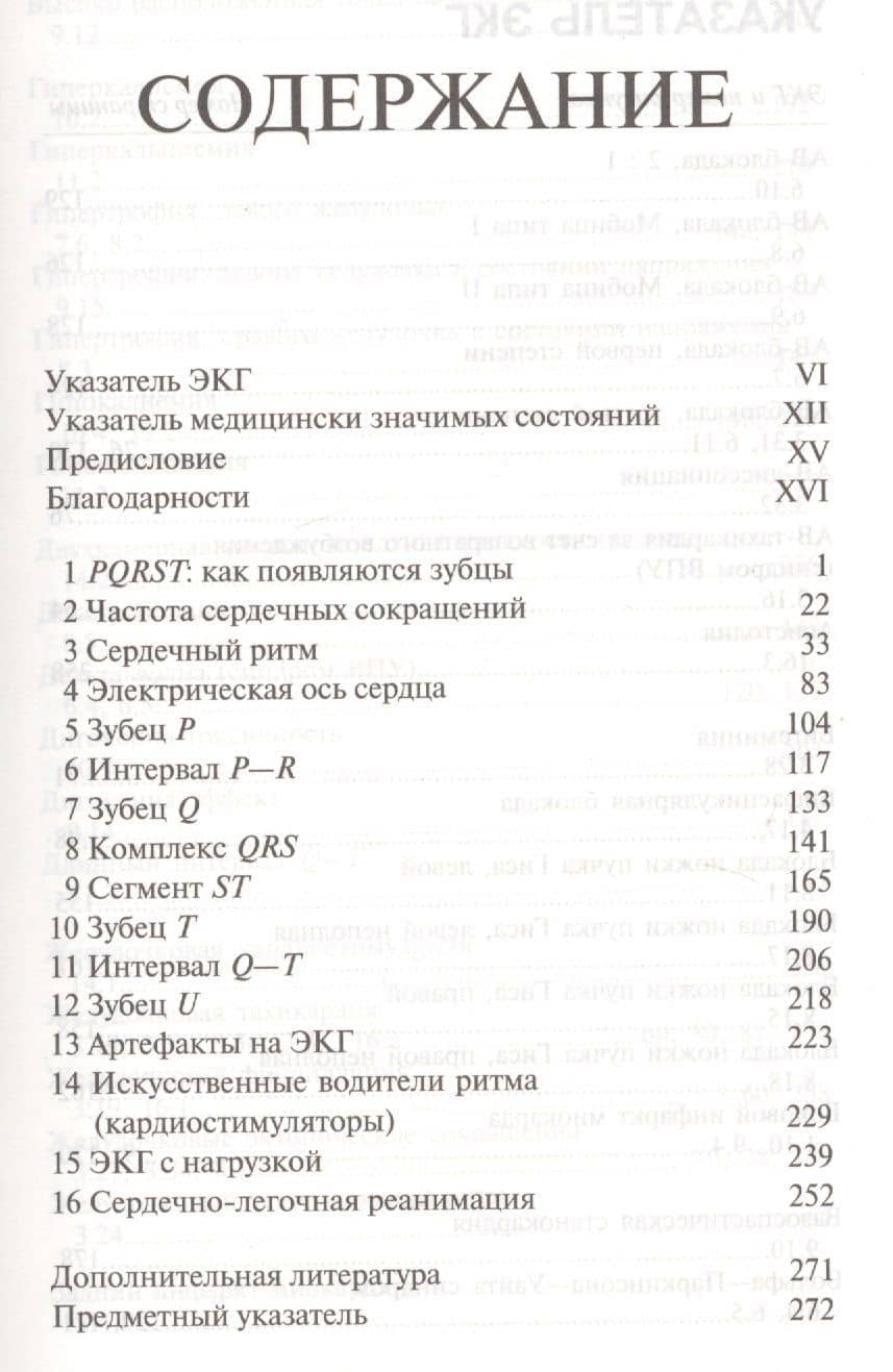 Расшифровка ЭКГ. Практическое руководство (2)