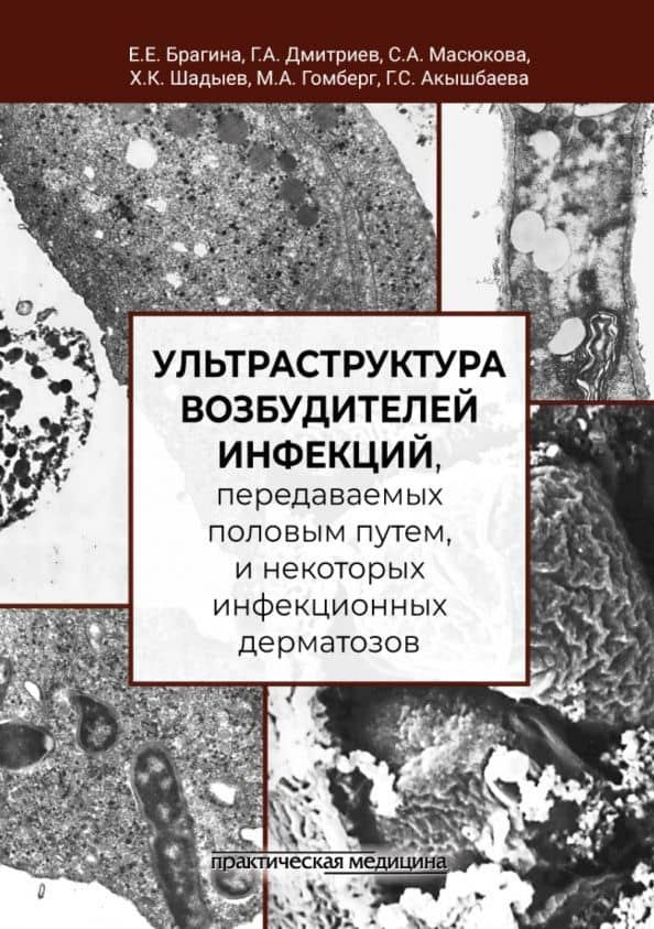 Ультраструктура возбудителей инфекций, передаваемых половым путем — Елизавета Ефимовна Брагина