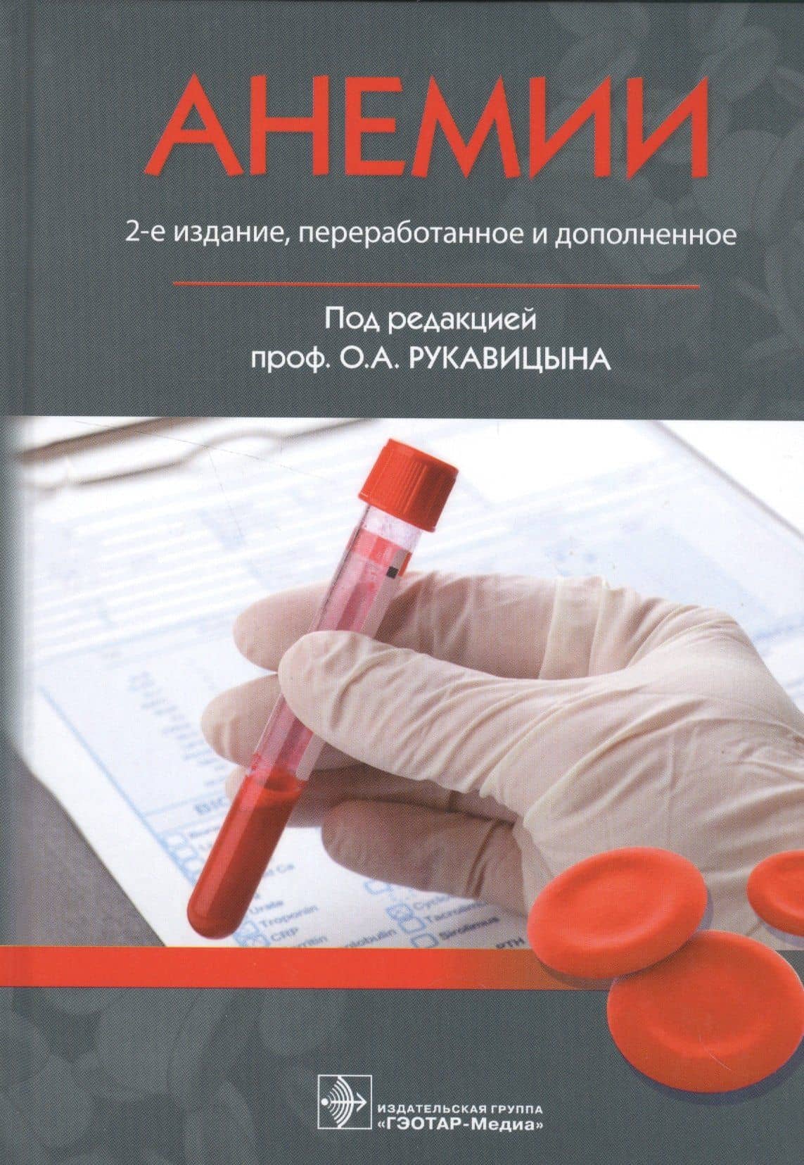 Анемии