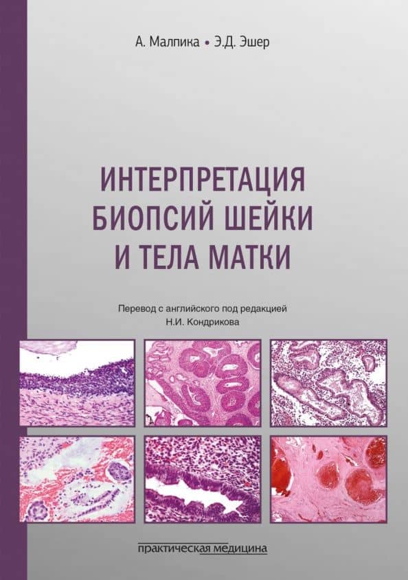 Интерпретация биопсий шейки и тела матки — Анаис Малпика