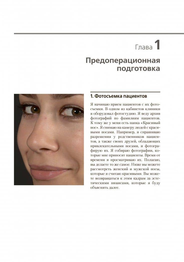Эстетическая септоринопластика — Барыш Чакыр (3)