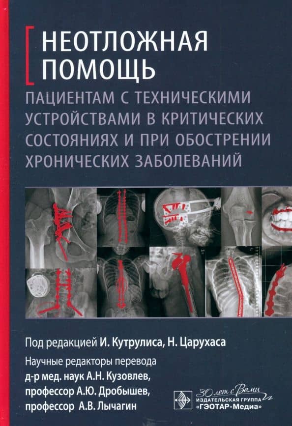 Неотложная помощь пациентам с техническими устройствами в критических состояниях — Иоаннис Кутрулис